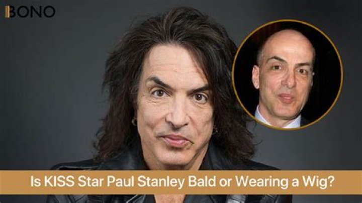 Is Paul Stanley Truly Bald: Debunking The Hair Loss Myth