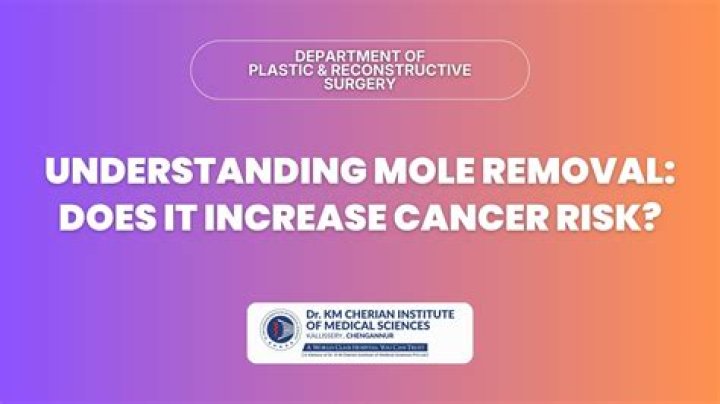 Richard Thomas Mole Removal: Fact Or Fiction?